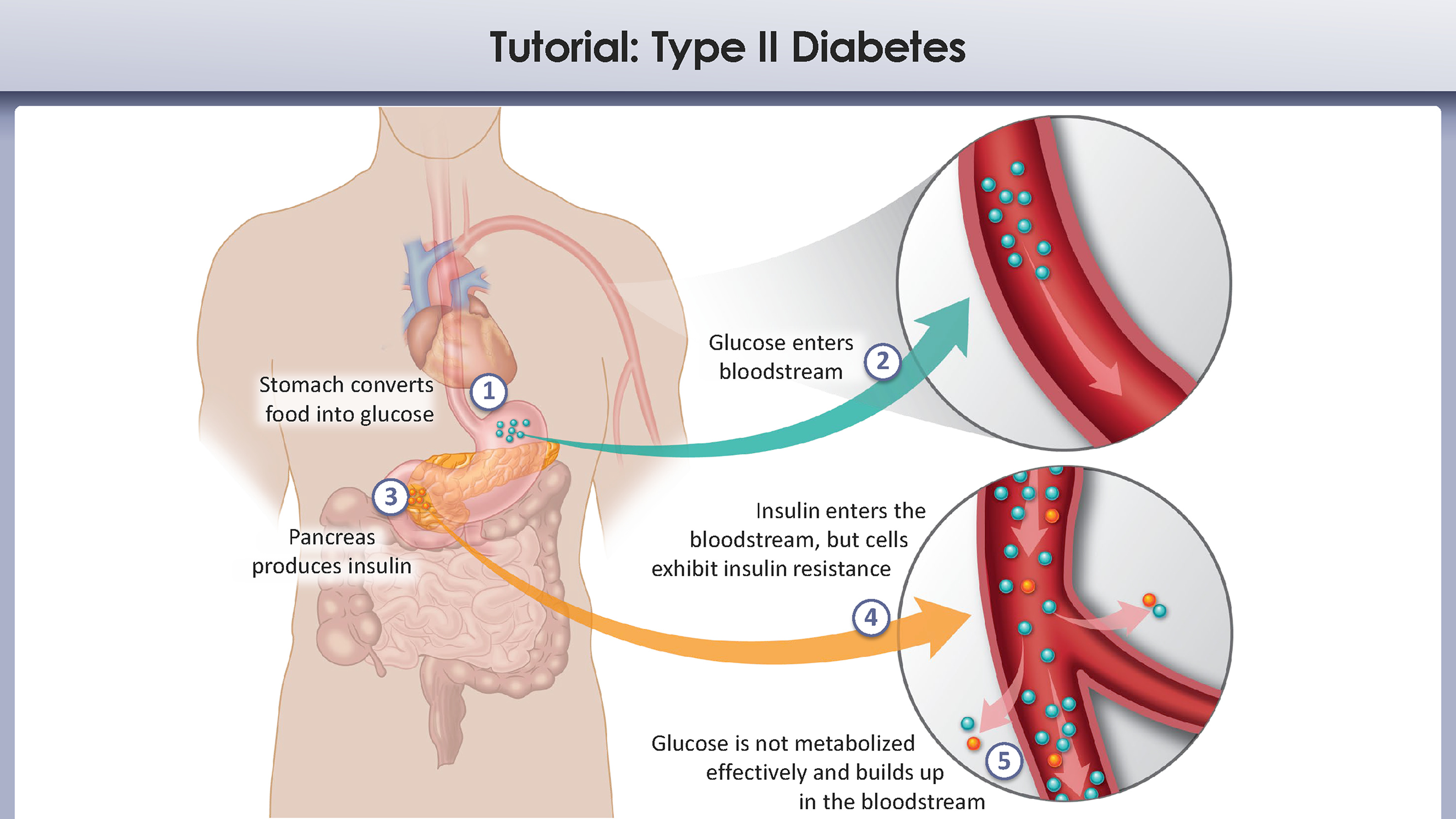 Illustration diabetes gluc mon 2 of 3