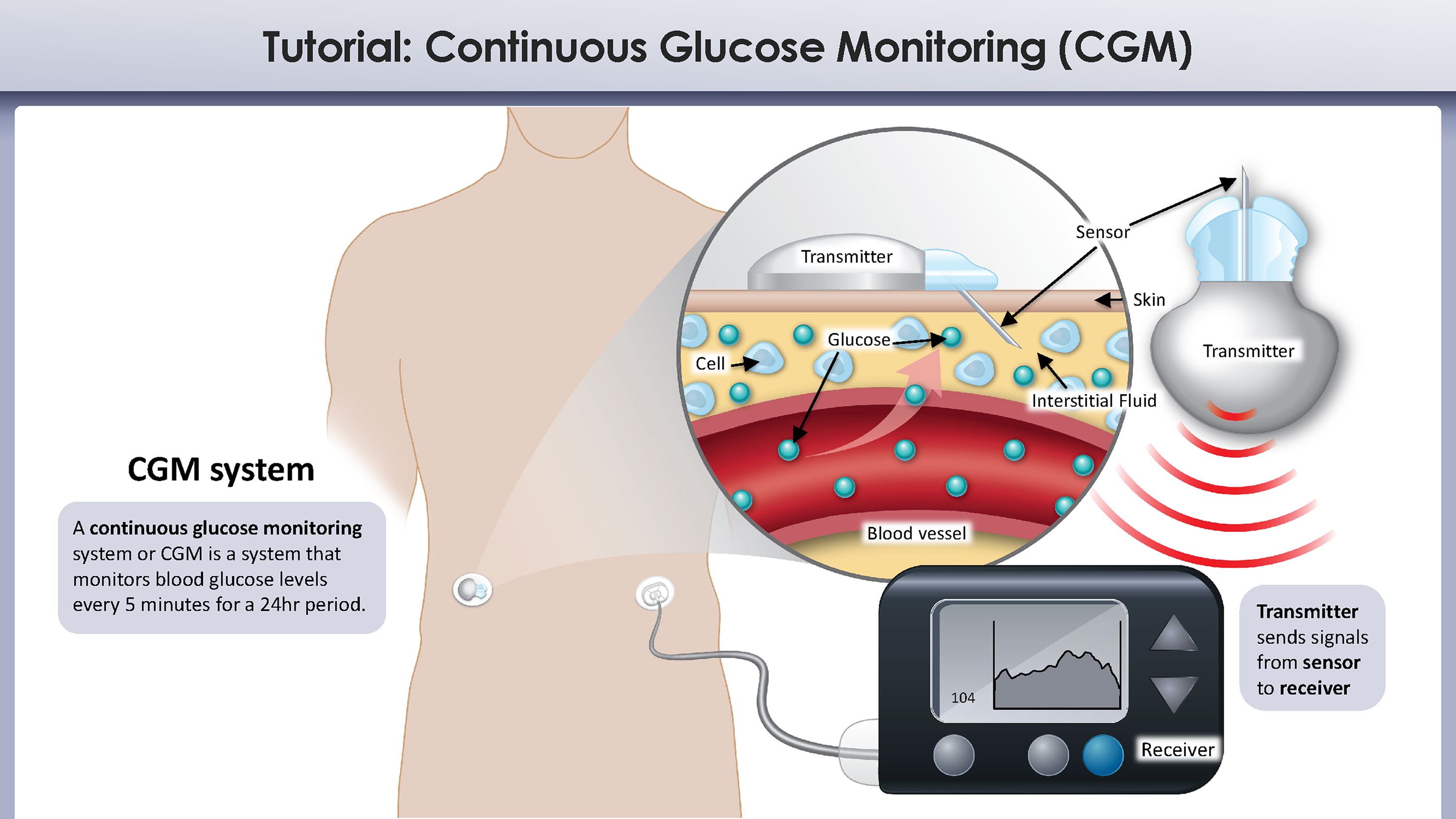 Illustration diabetes gluc mon 3 of 3